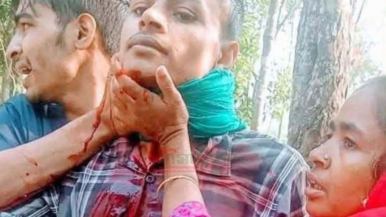 আদিতমারীতে পারিবারিক কলহে যুবকের আত্মহত্যার চেষ্টা,নিজের লিঙ্গ ও গলা কাটলেন যুবক ‎ ‎